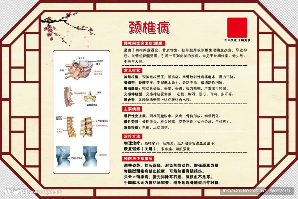 頸椎病