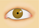 眼睛