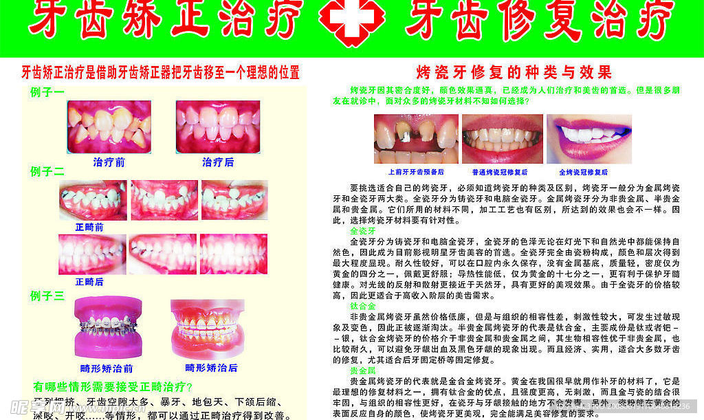 牙科(牙齿对比图)