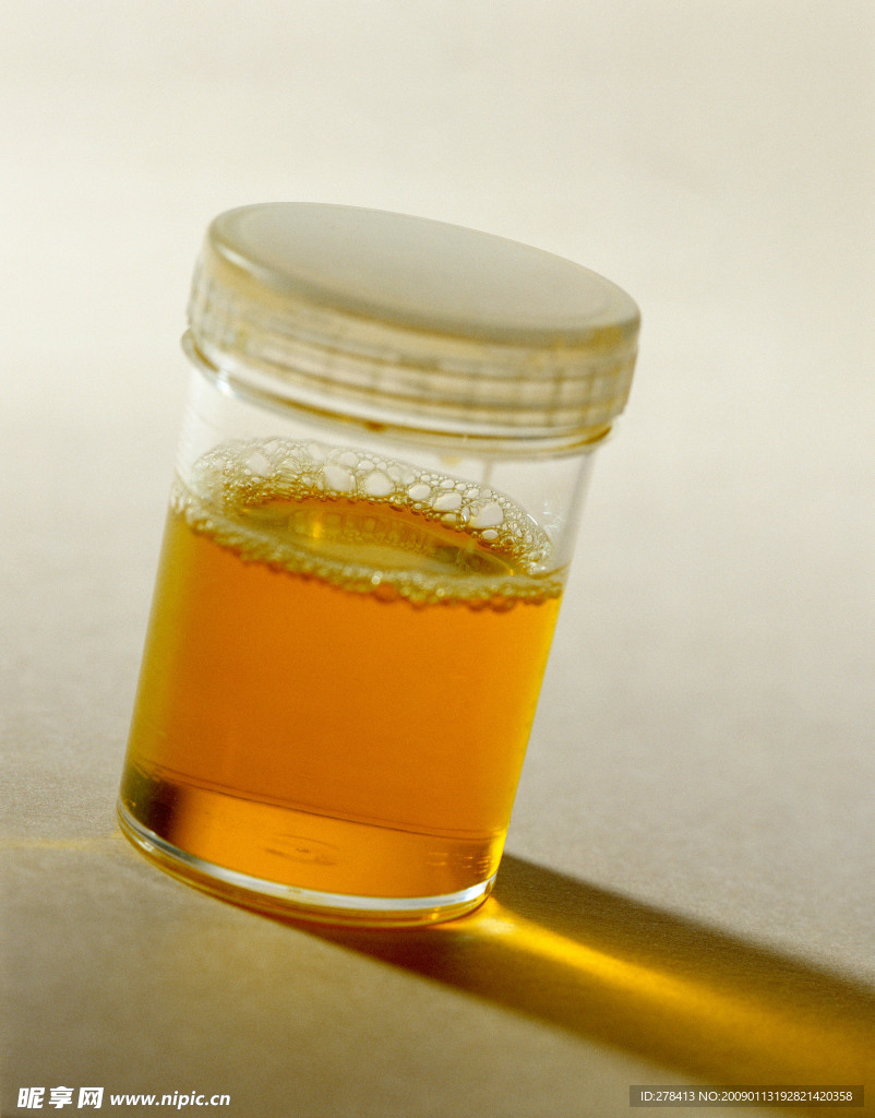 尿样 尿液