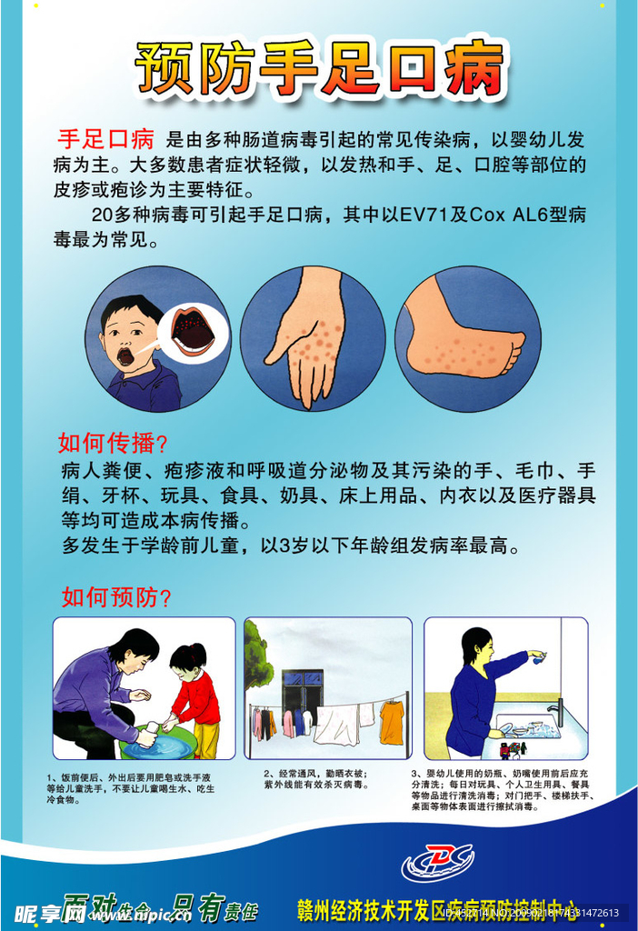 手足口病预防