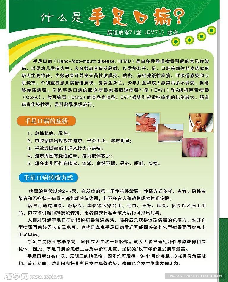 手足口病宣传