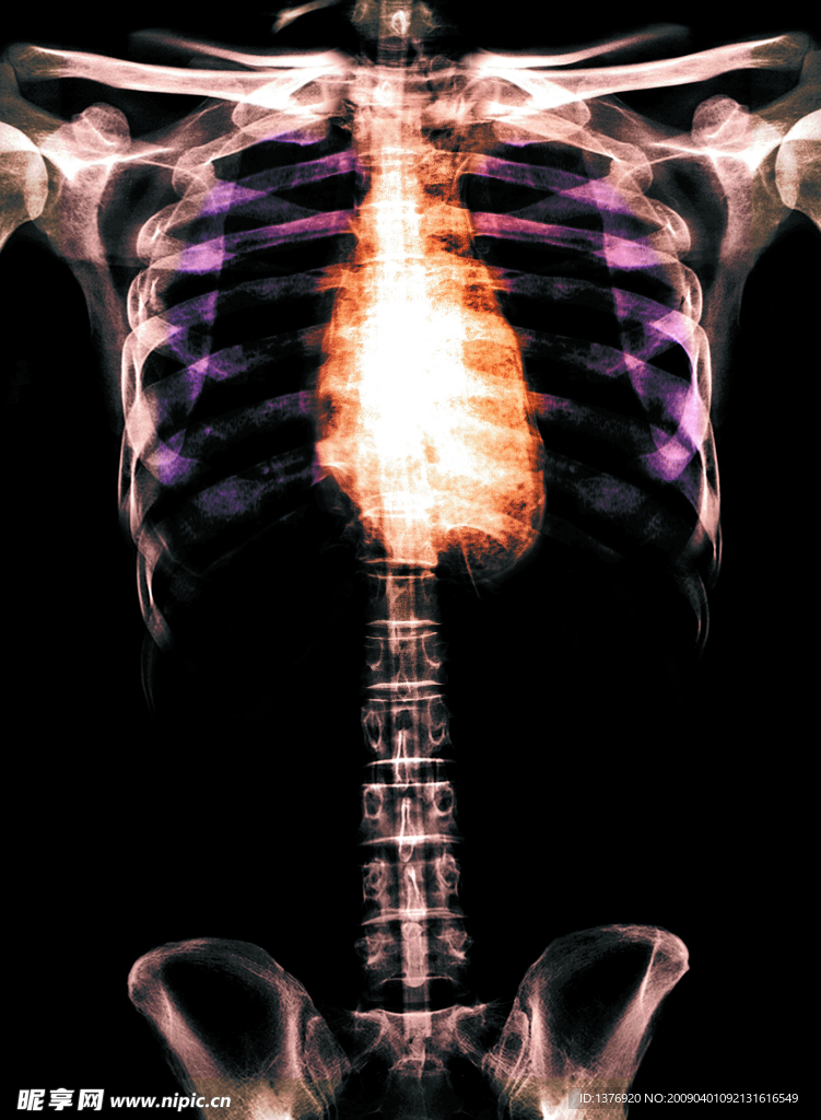 骨骼 透视 X光 科技  身躯 胸
