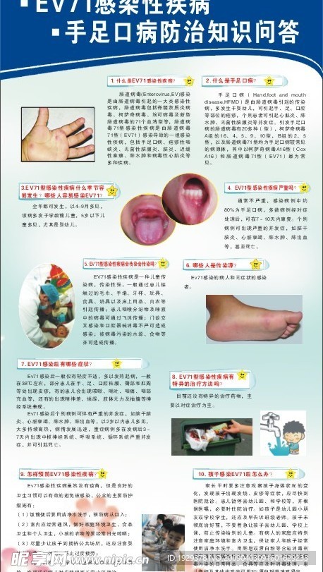 手足口病