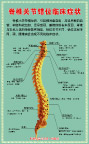 脊椎关节错位临床症状