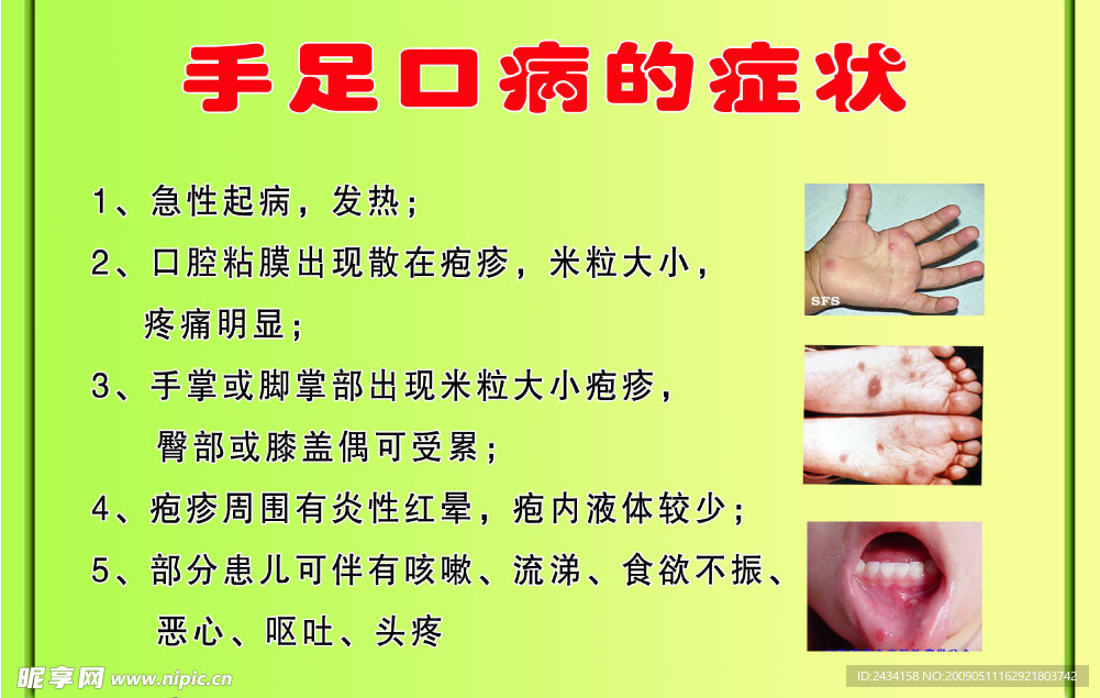 手足口病的症状
