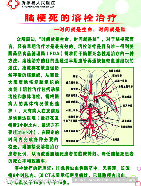 脑梗死的溶栓治疗