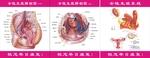 女性生殖解剖图