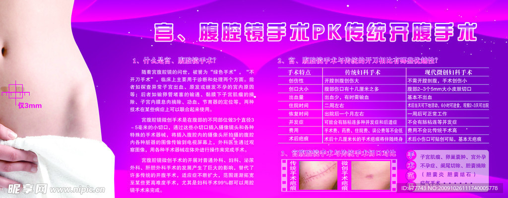 宫腹腔镜手术PK传统开腹手术