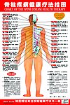 脊柱疾病健康疗法挂图