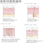 皮肤问题图解