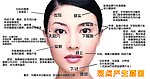 美白雀斑2