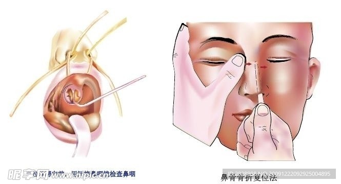 耳鼻喉手绘科谱