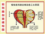 前列腺剖面模拟图
