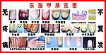 灰指甲
