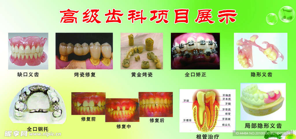 牙科展示图