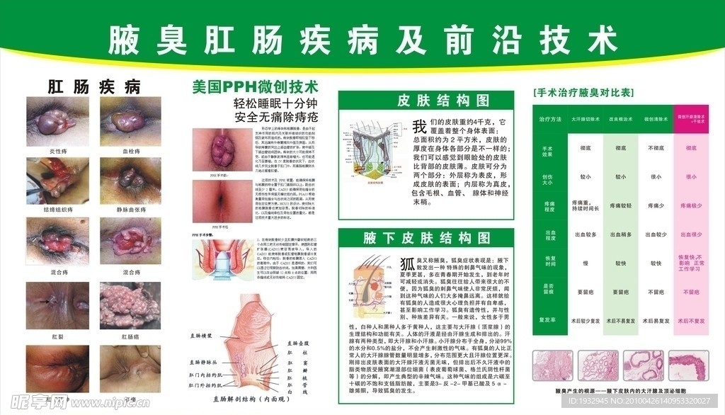 腋臭肛肠挂图