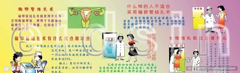 结扎相关事项