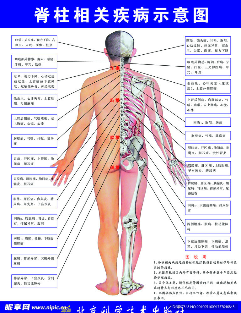 脊椎相关疾病