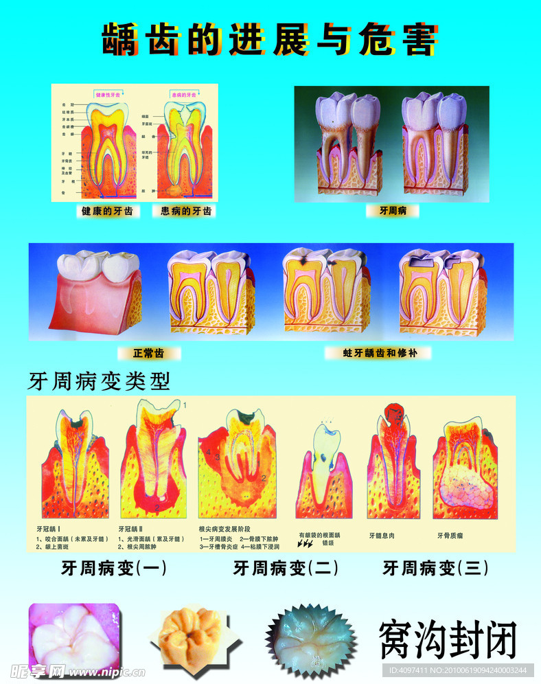 牙齿