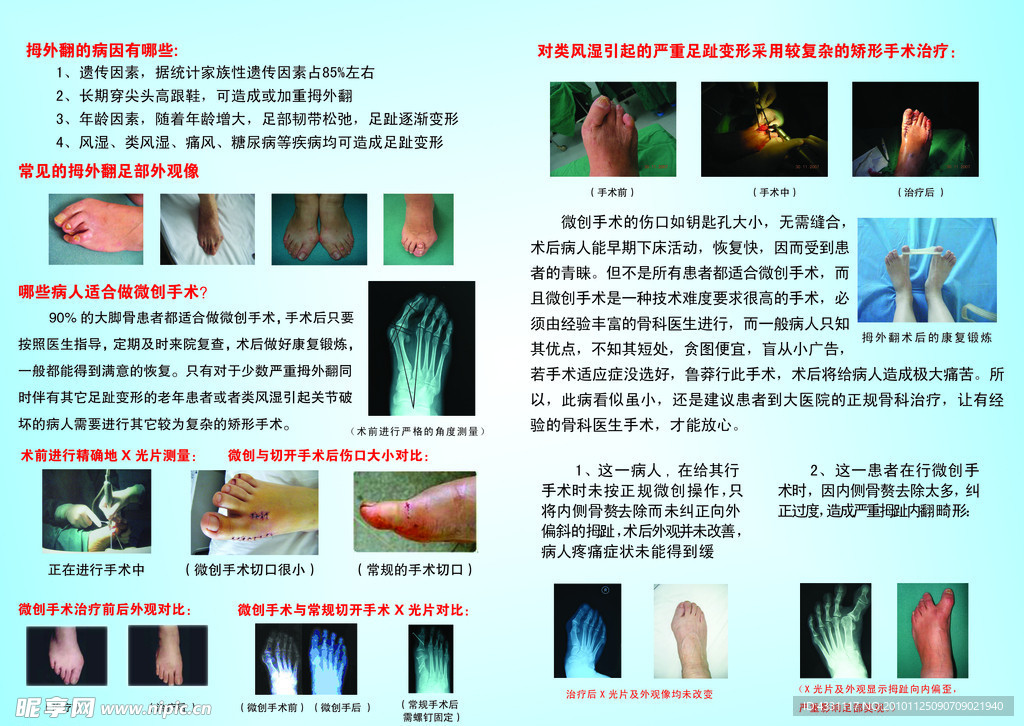 骨科足病治疗中心