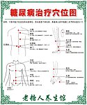 糖尿病治疗穴位