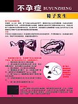 精子的发生