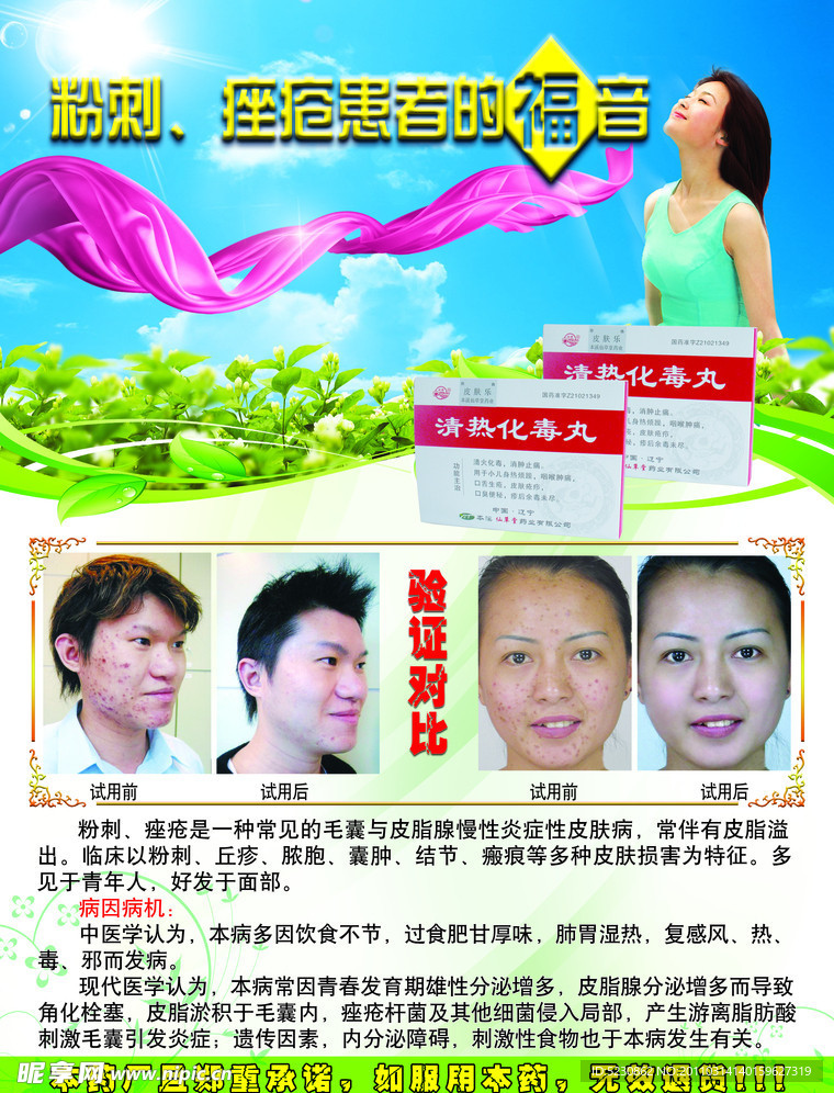 青春痘药品宣传单