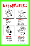 紧急急救法
