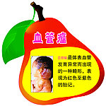缺陷标牌
