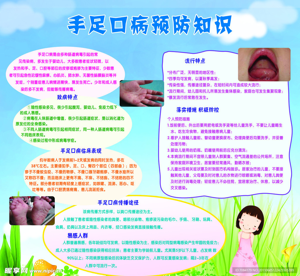 手足口病预防知识