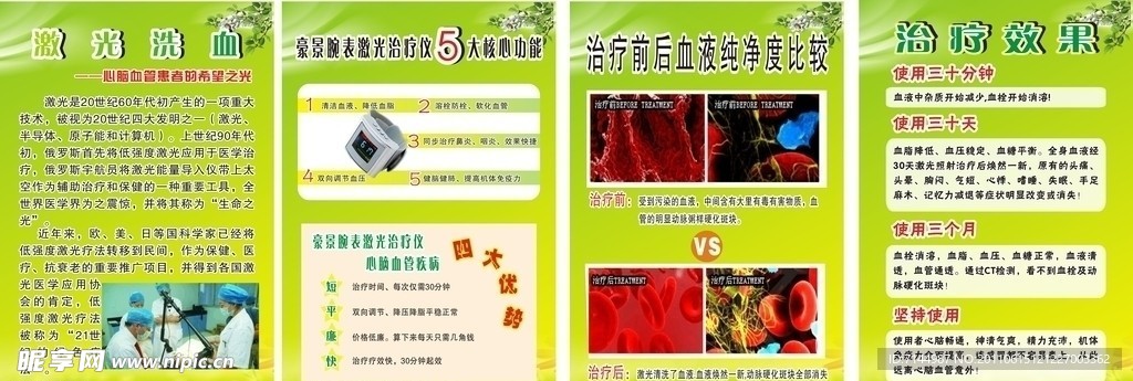 激光洗血展板