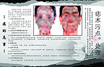 痣术污点处理