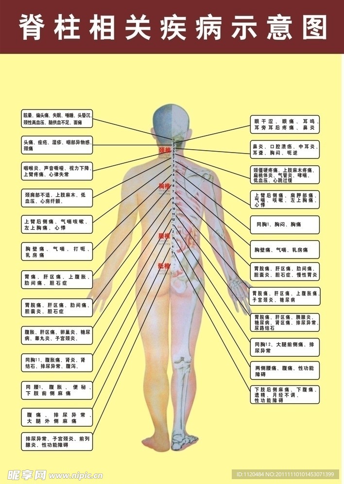 脊柱相关疾病