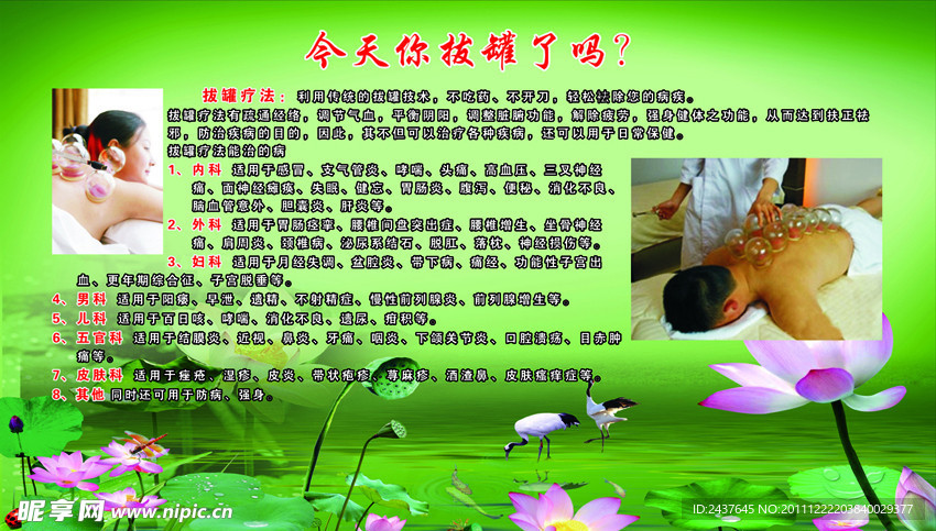 理疗馆拔罐介绍