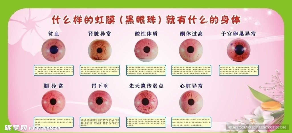 虹膜保健分析图