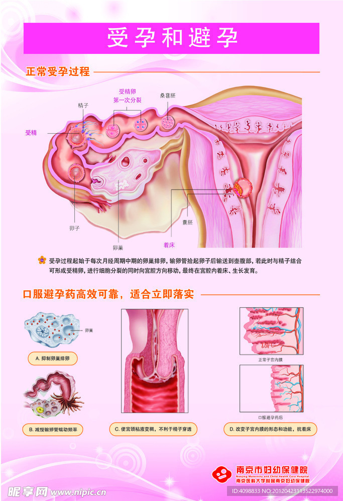 医院妇科展板