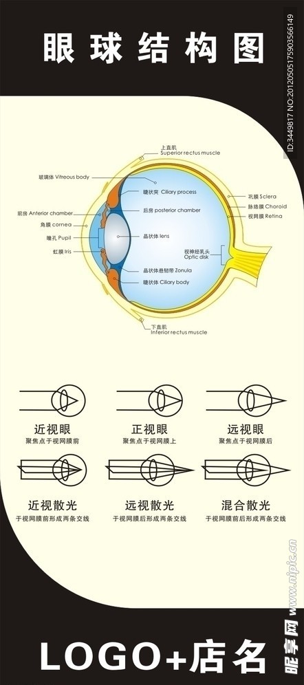 眼球结构图