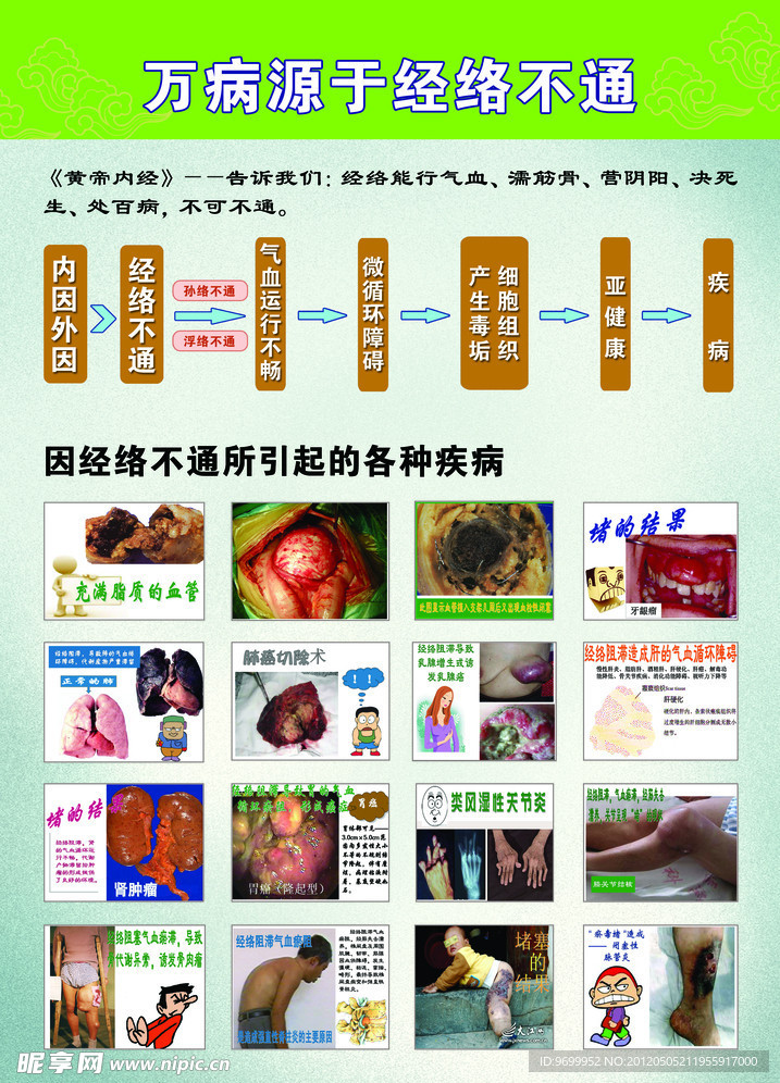 万病源于经络不通