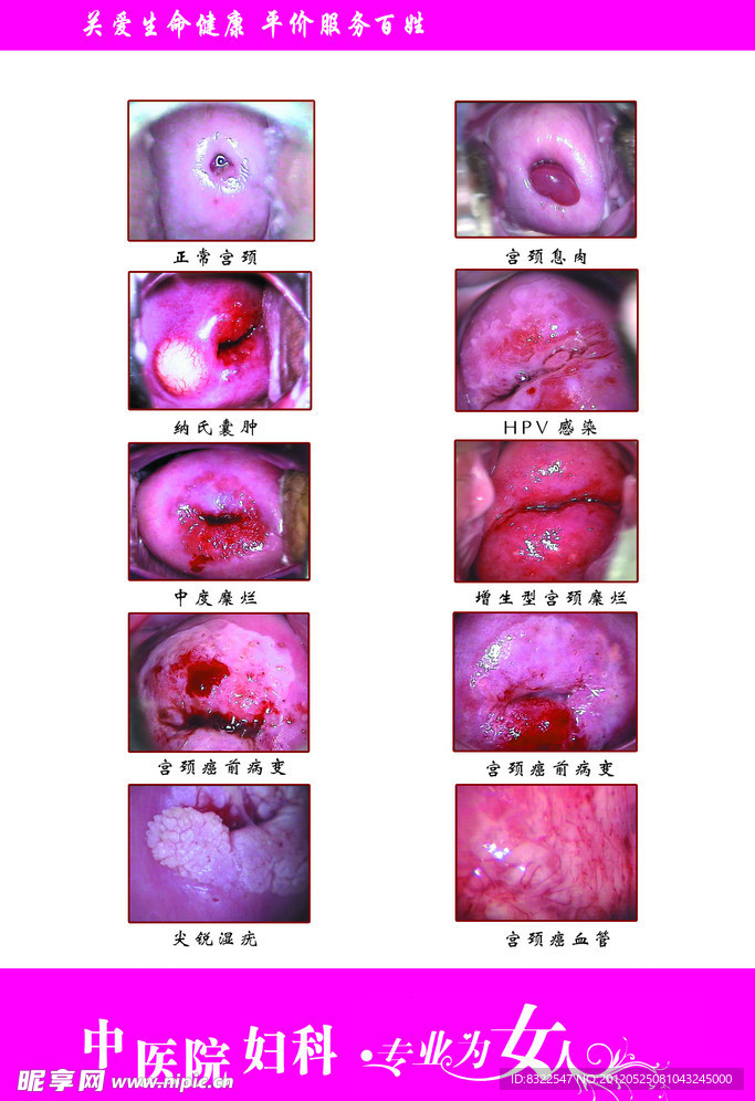 妇科展板