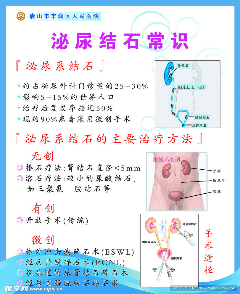 泌尿结石常识