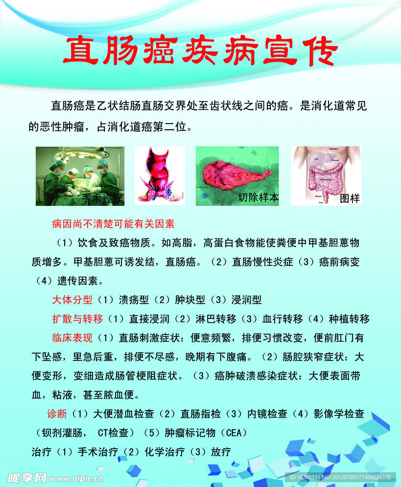 直肠癌疾病