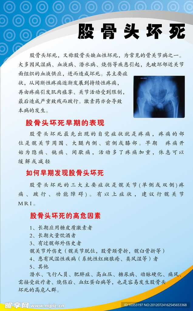 股骨头坏死