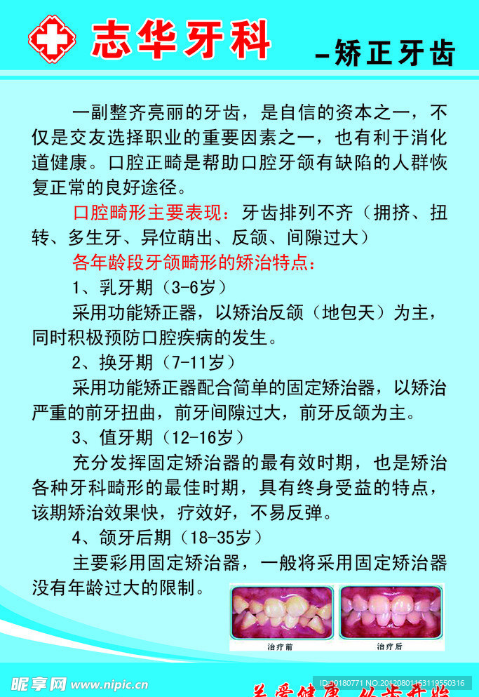 志华牙科矫正牙齿