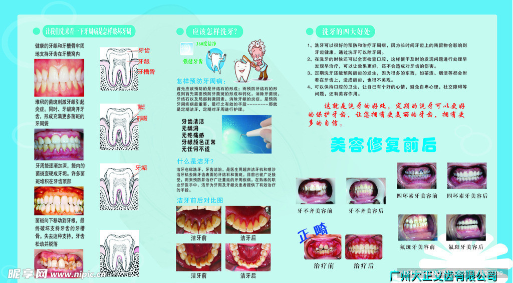 口腔美容修复