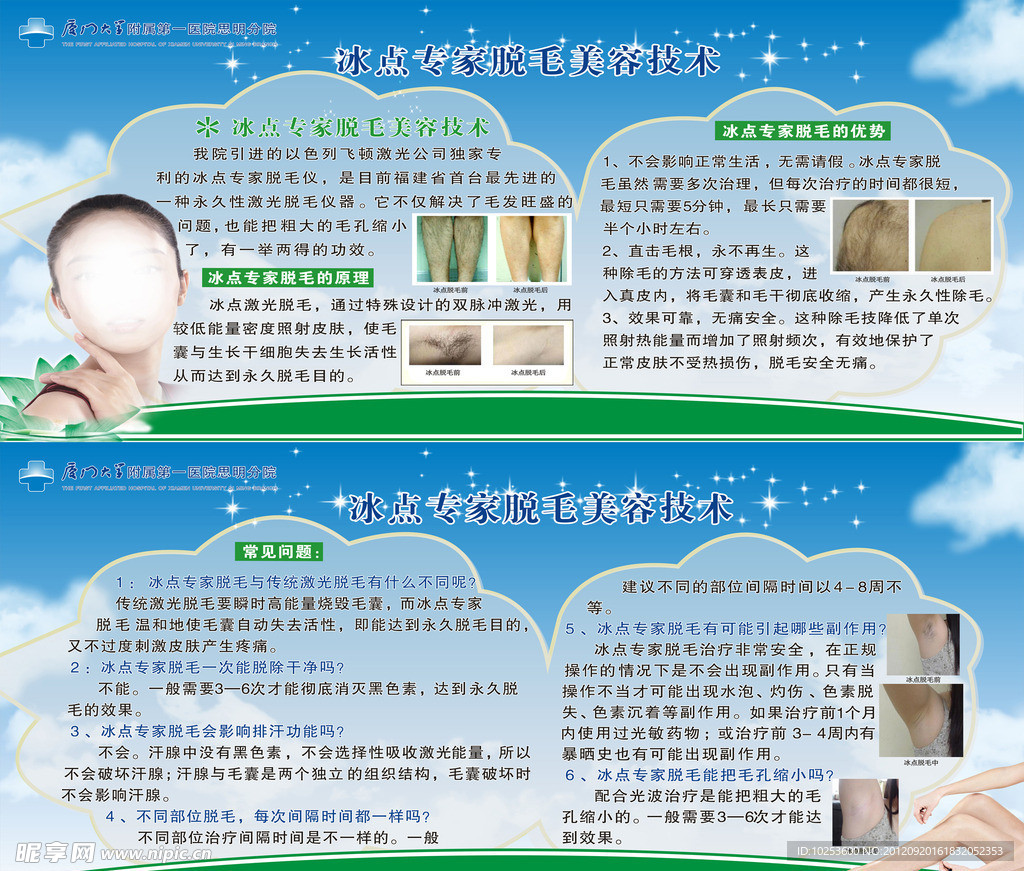 冰点脱毛 美容技术