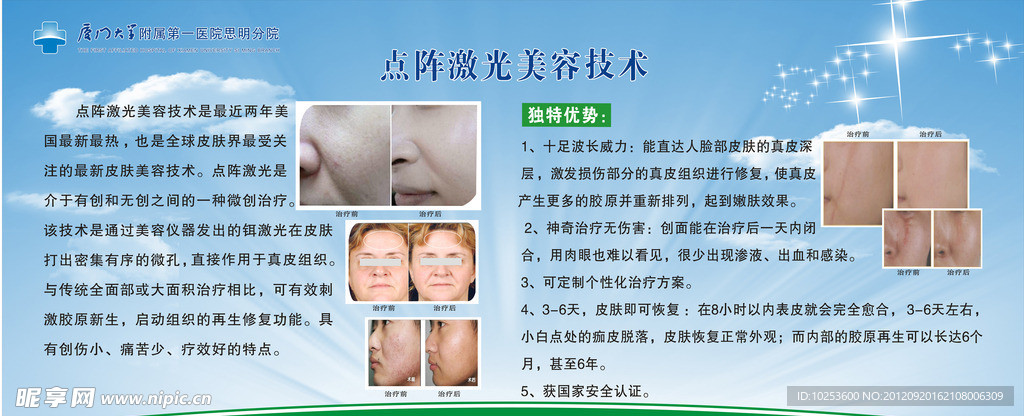 点阵激光 美容技术