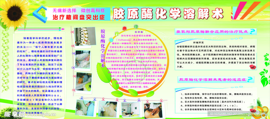 胶原酶化学溶解术