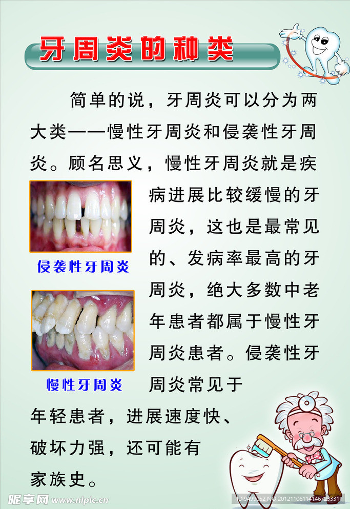 牙周炎的种类