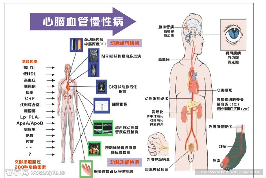 心脑血管慢性病